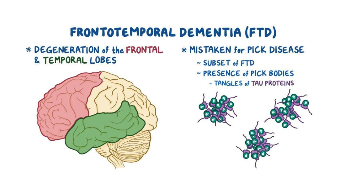 5 Simple Strategies to Help Support Loved Ones Suffering From Frontotemporal Dementia